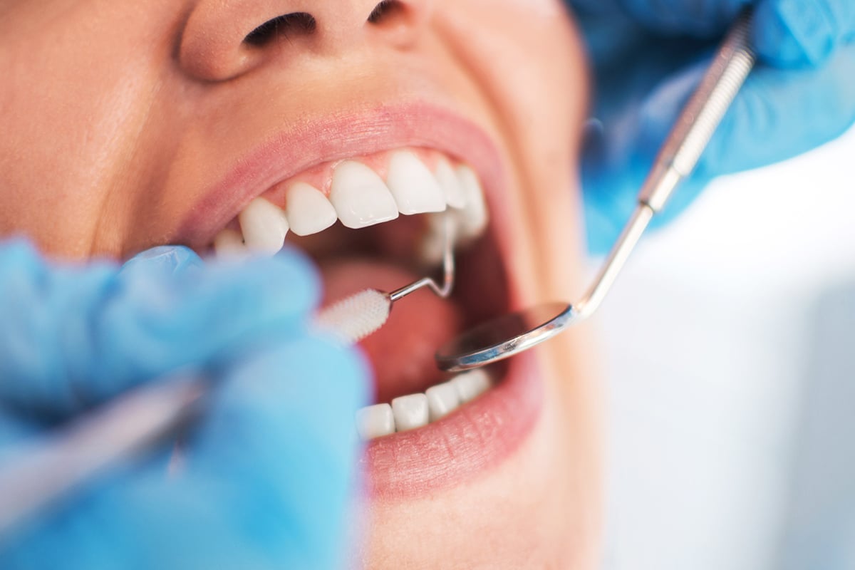 Factors that affect the cost of professional teeth whitening in bernardsville blog