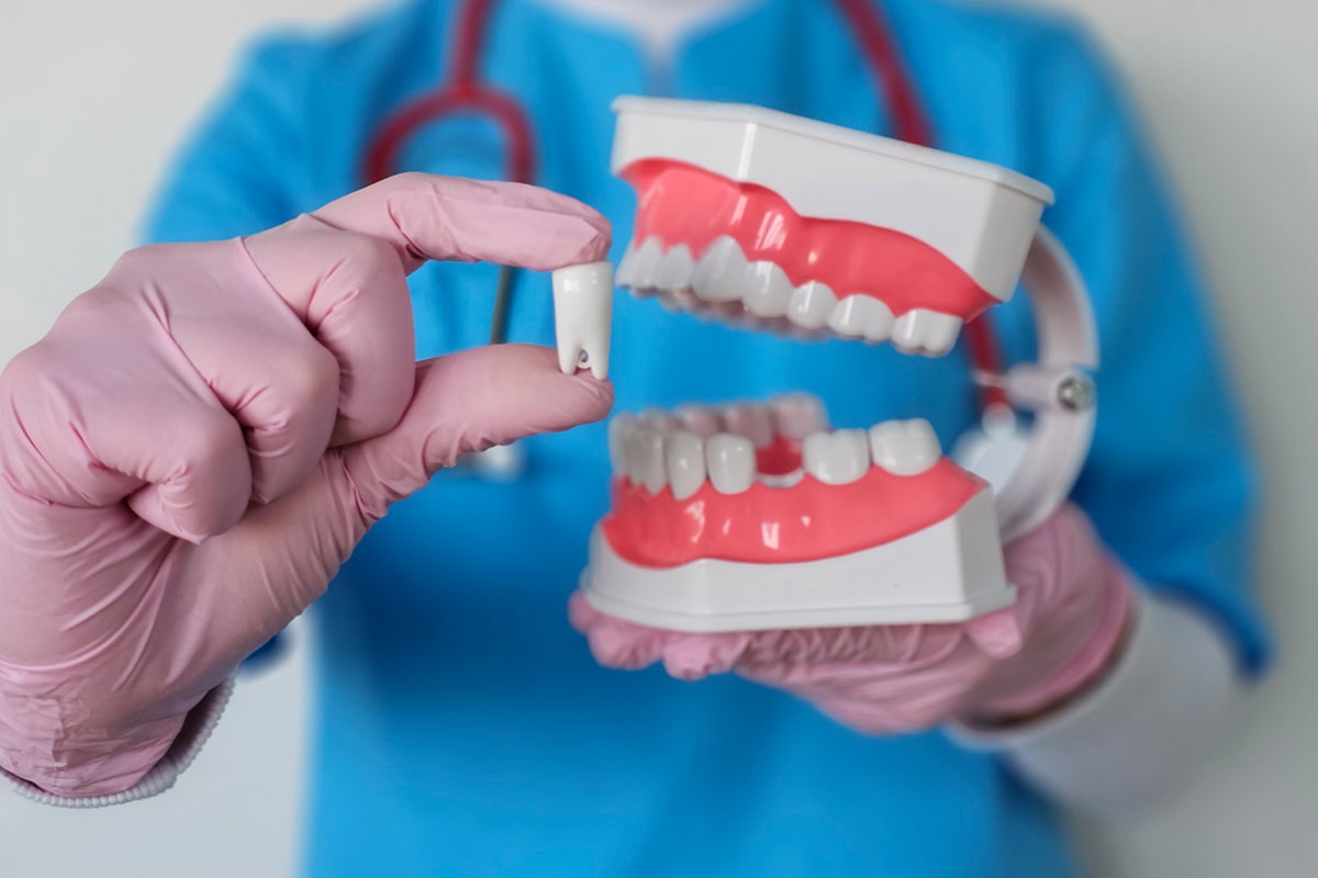 Why implant restorations cost what they do in bernardsville materials technology and expertise blog